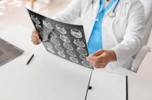 Average head injury settlement amounts Texas featured image